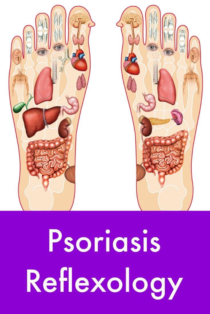 psoriasis reflexology