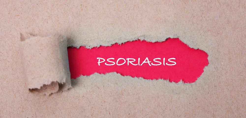 Stelara May Block Protein That Fights Psoriasis, Study Says