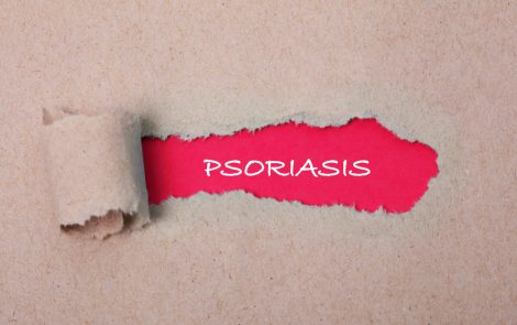 OWCP and mediq Collaborate to Introduce Cannabinoid-based Psoriasis Cream in Germany
